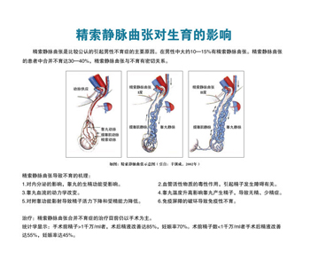 精索静脉曲张的诱发因素有哪些