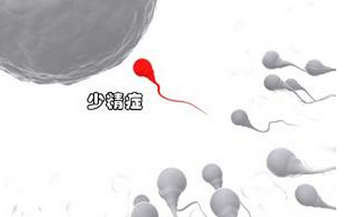 哪些原因导致男性少精症