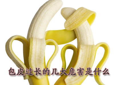 包皮过长术后需怎样护理