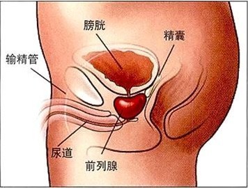 嵊州治疗精囊炎的费用是多少