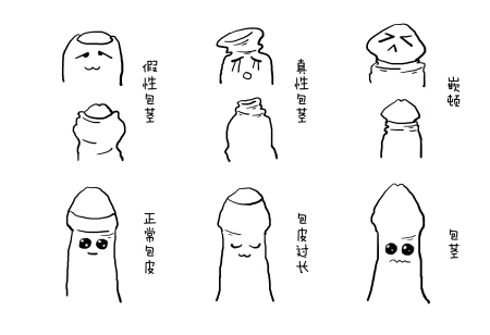 嵊州做包茎手术哪家医院最便宜