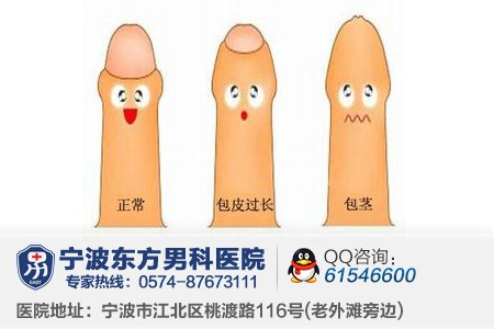 包茎会对嵊州男性造成哪些危害